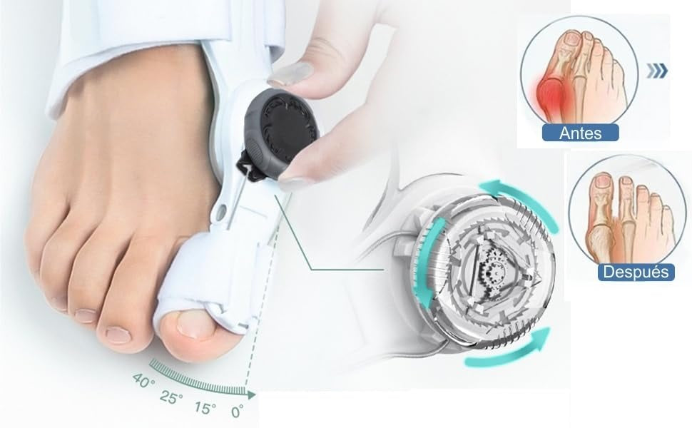 CORRECTOR DE JUANETES PARA MUJERES Y HOMBRES